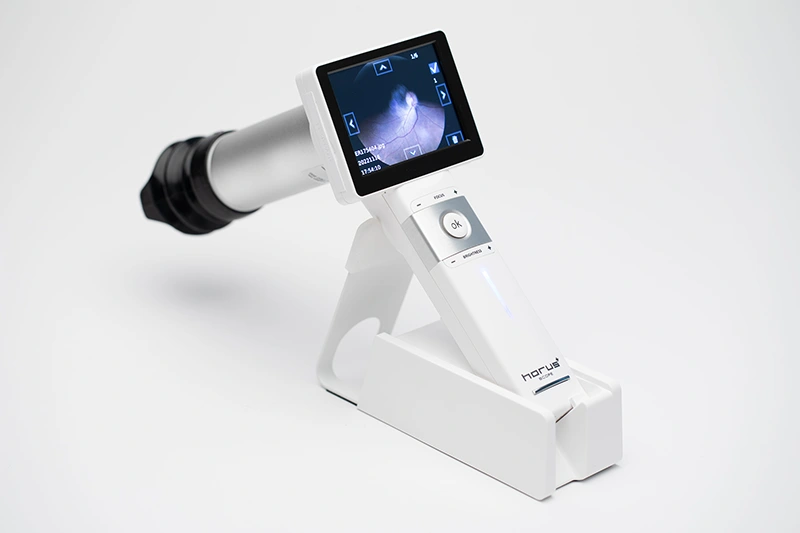 Riester Ophthalmoscope Camera 02 Photo -mobile