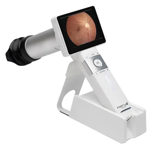 Riester Digital Ophthalmoscope Camera Photo